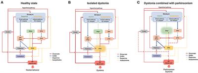 Dystonia and the pedunculopontine nucleus: Current evidences and potential mechanisms